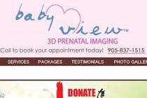 Baby View