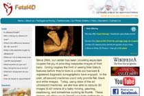 Fetal4D
