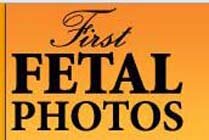 First Fetal Photos