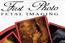 First Photo Fetal 3D
